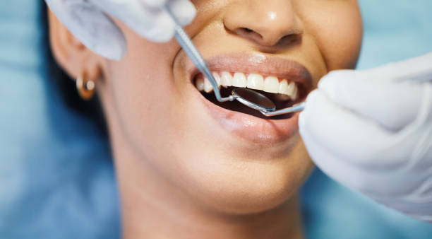 Best Emergency Wisdom Teeth Removal in Inola, OK
